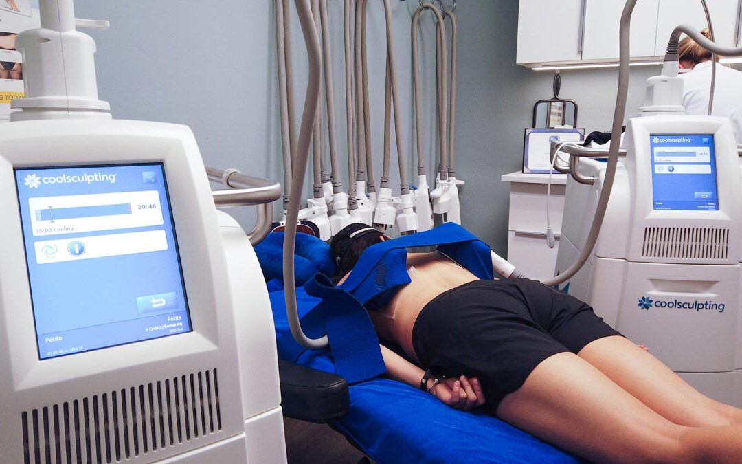 How Much Does CoolSculpting Cost?