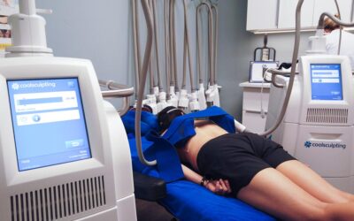 How Much Does CoolSculpting Cost?