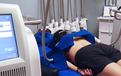 What is the CoolSculpting® Experience at BB Medical Esthetics?