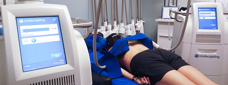 What is the CoolSculpting® Experience at BB Medical Esthetics?