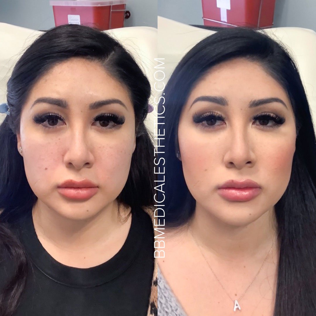 Dermal-B&A-1