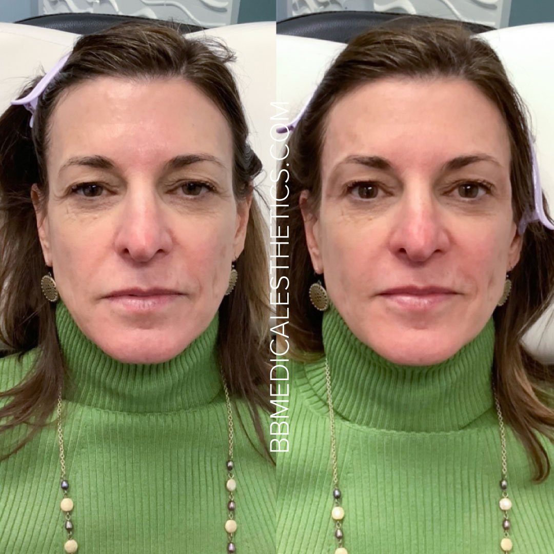 Dermal-B&A-2