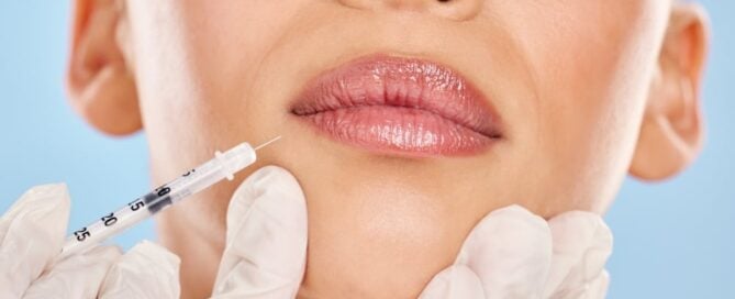 #1 Best Lip Filler Injector in Boise