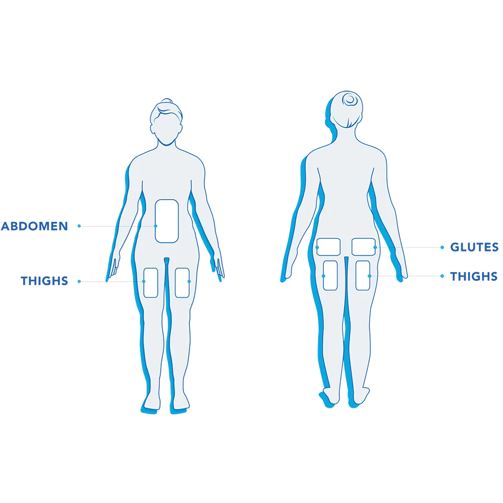 CoolTone Treatment Areas
