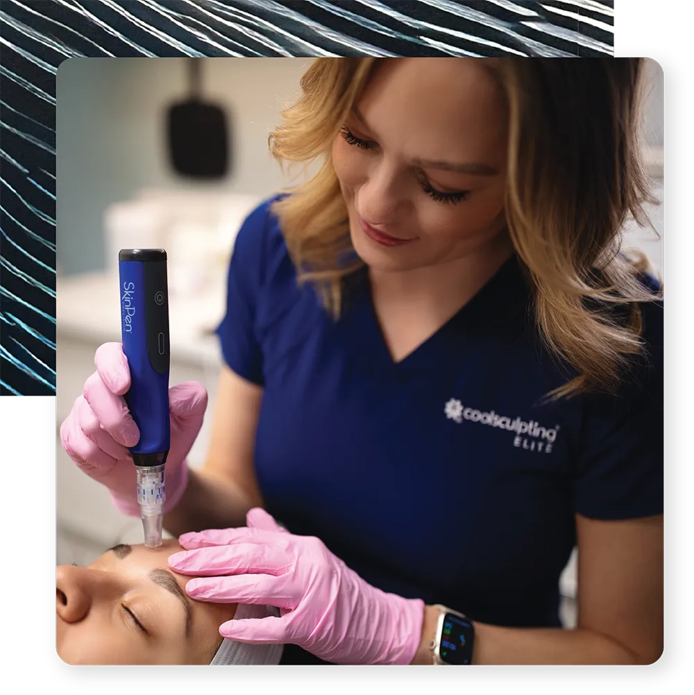 Melissa Microneedling