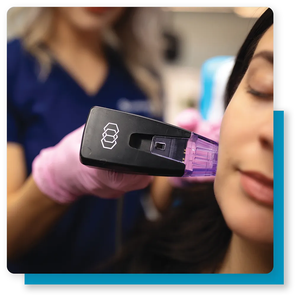 Morpheus 8 Treatment in process web