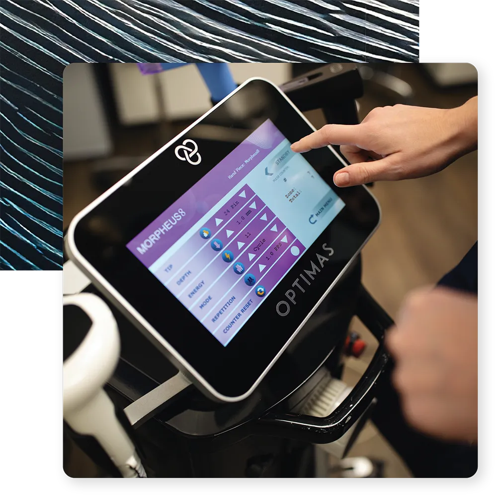 Optimas System Screen