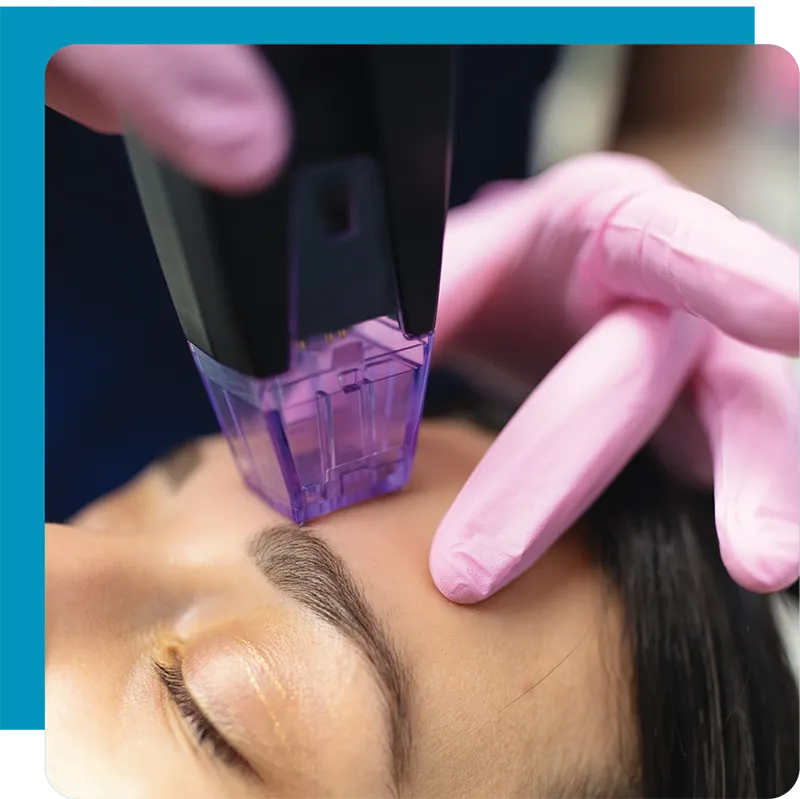 Facial Rejuv Morpheus8