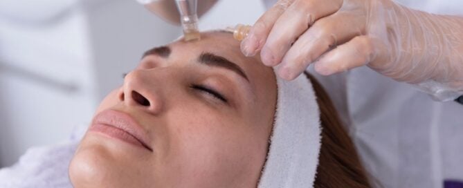 How to Prepare for a Microneedling Appointment Near Meridian, Idaho (And What to Expect)