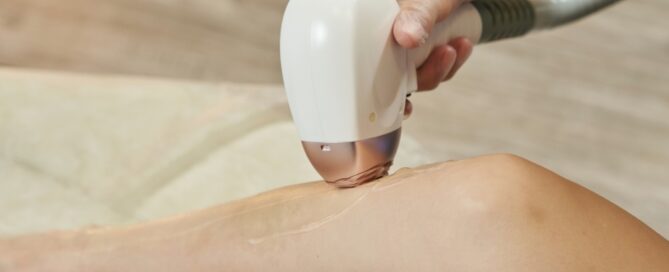 Wondering What You Pay for Laser Hair Removal Per Session in Meridian, Idaho? Click Here!