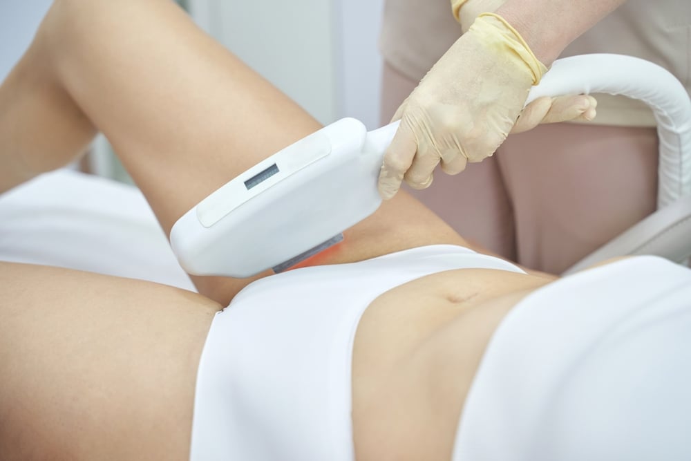 Brazilian Laser Hair Removal Prices in Meridian, Idaho: What to Know Before You Commit