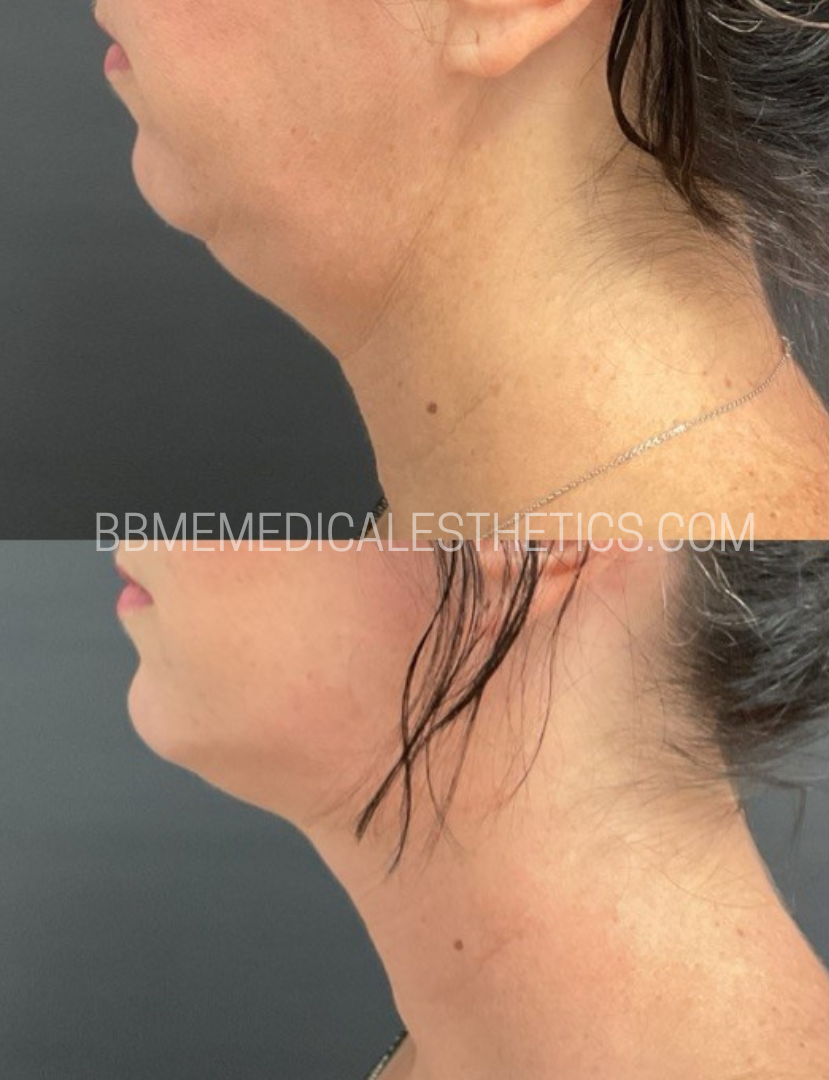 Add a subheading _1_