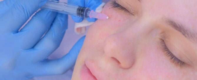 Longest-Lasting Under-Eye Filler in Eagle, Idaho: What to Know Before You Book