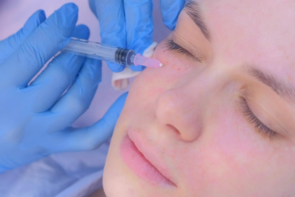 Cosmetologist,Doctor,Making,Multiple,Injections,Biorevitalization,In,Woman,Face,Skin Longest-Lasting Under-Eye Filler in Eagle, Idaho: What to Know Before You Book