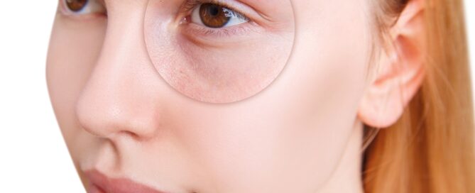 Best Under-Eye Filler Treatments Near Nampa Idaho