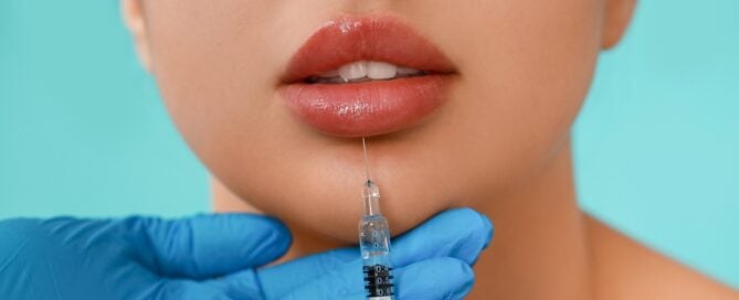 Affordable Lip Filler and Dermal Filler Treatments Near Star, Idaho